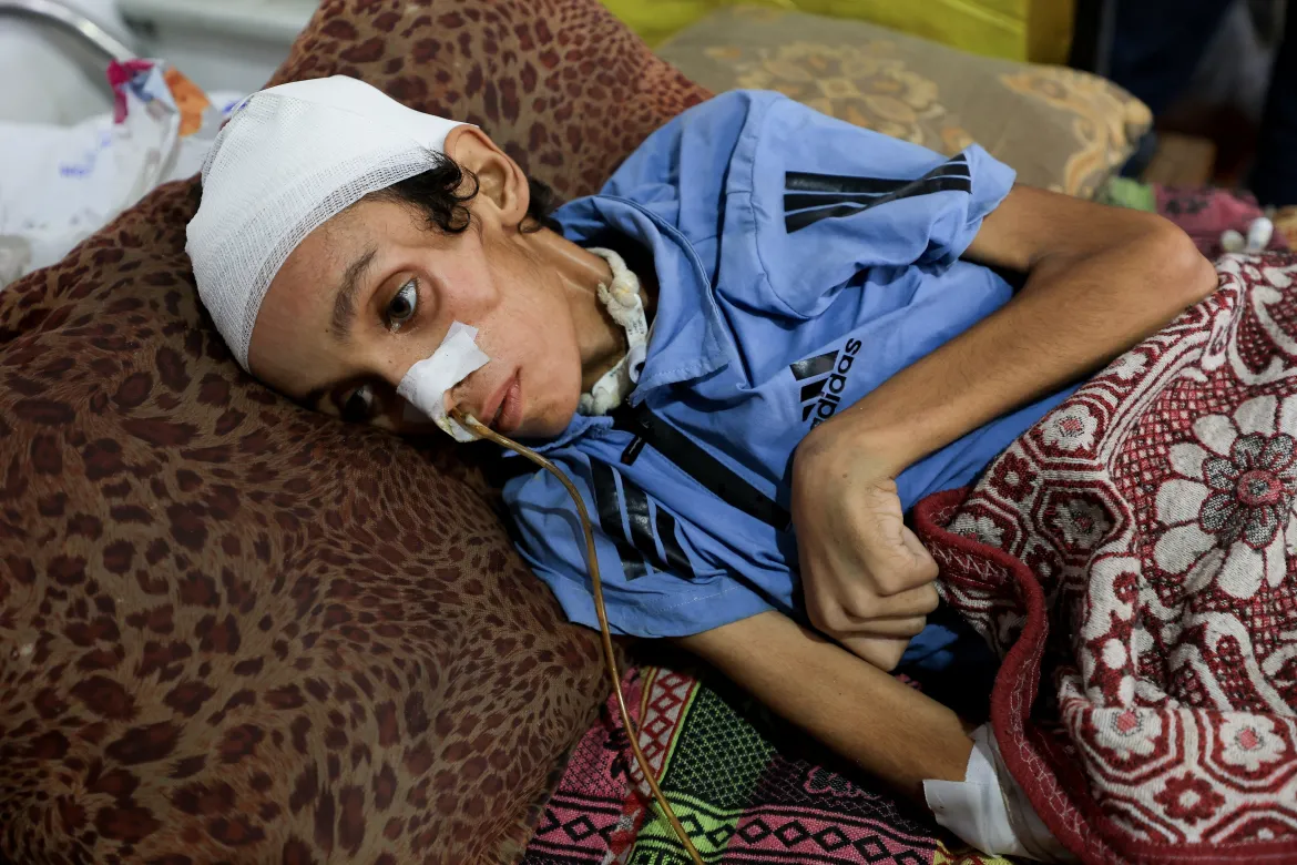 غزہ میں بچوں کو بھوک اور غذائی قلت کی تباہ کن سطح کا سامنا