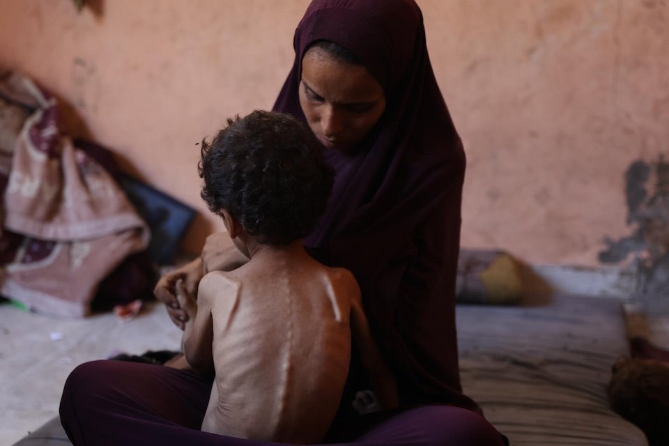 غزہ بدترین قحط کی صورت حال کا سامنا کر رہا ہے، ڈبلیو ایچ او
