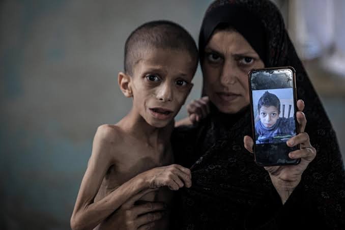 غزہ پر صبح سویرے حملوں میں 12 فلسطینی شہید، بھوک کی شدت سے 4 بچوں سمیت مزید گیارہ شہید