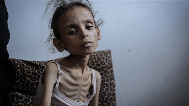 غزہ میں قحط عالمی برادری کے ضمیر پر ہمیشہ ایک داغ رہے گا، سعودیہ
