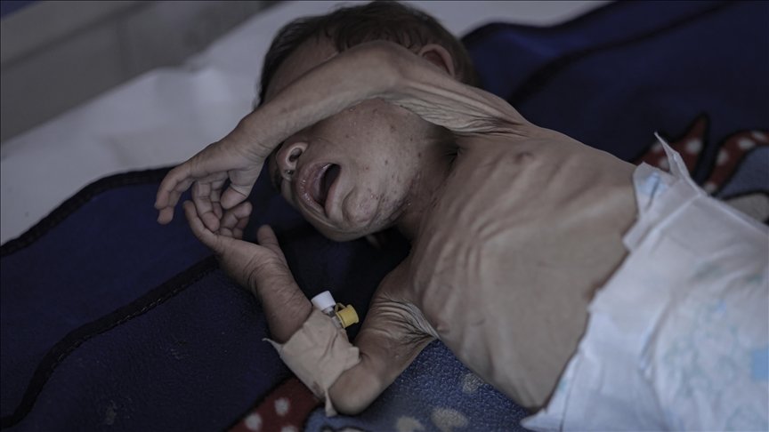غزہ میں روزانہ 28 بچے موت کا شکار ہو رہے ہیں، یونیسیف